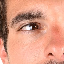 Common Eye Infections